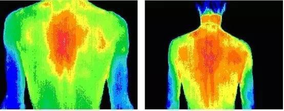 熱成像在臨床診斷方面的作用
